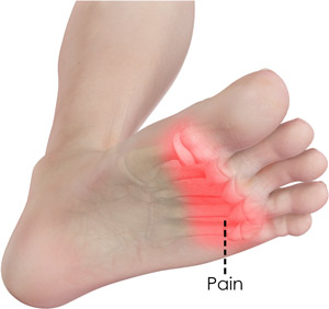 Foot Pain